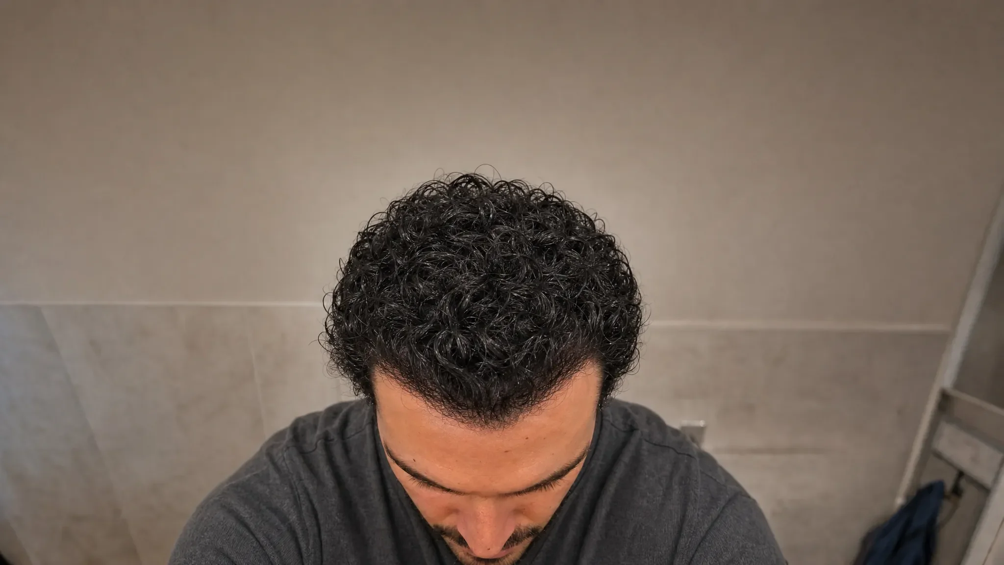 Recreación fotográfica: el mismo cabello a los seis meses de tratamiento
