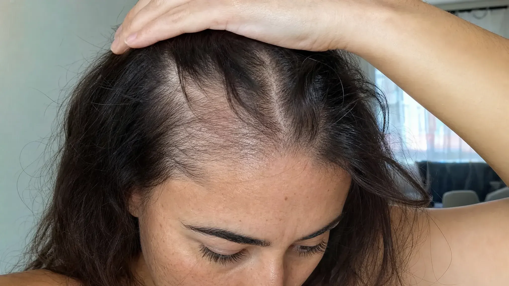 Recreación fotográfica: la densidad del cabello el día 1 del tratamiento capilar