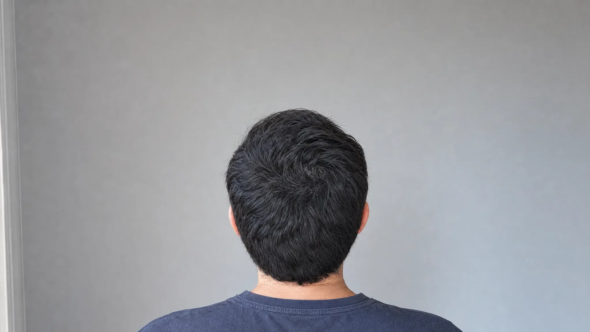 Recreación fotográfica: el mismo cabello a los seis meses de tratamiento