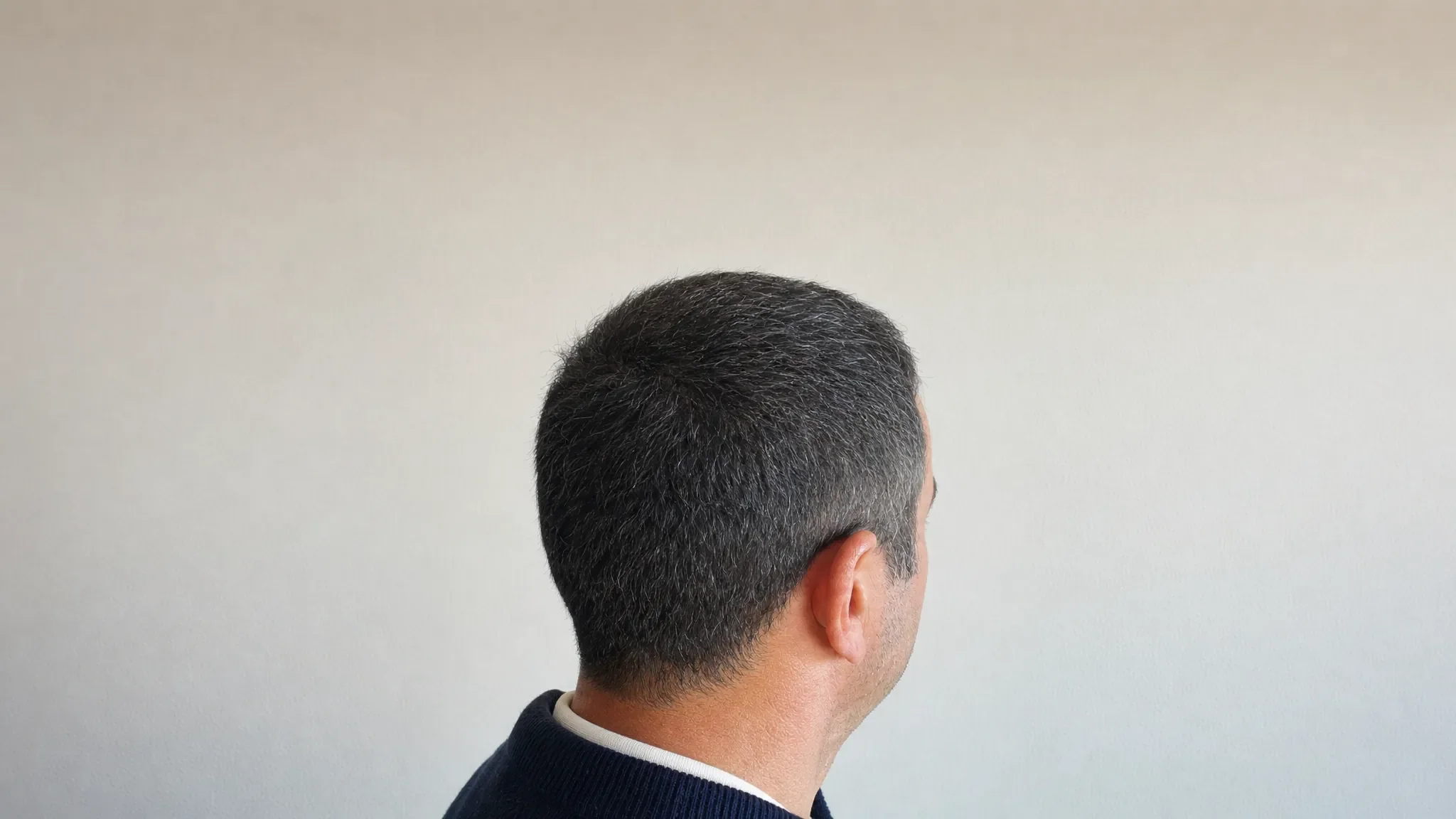 Recreación fotográfica: el mismo cabello a los seis meses de tratamiento